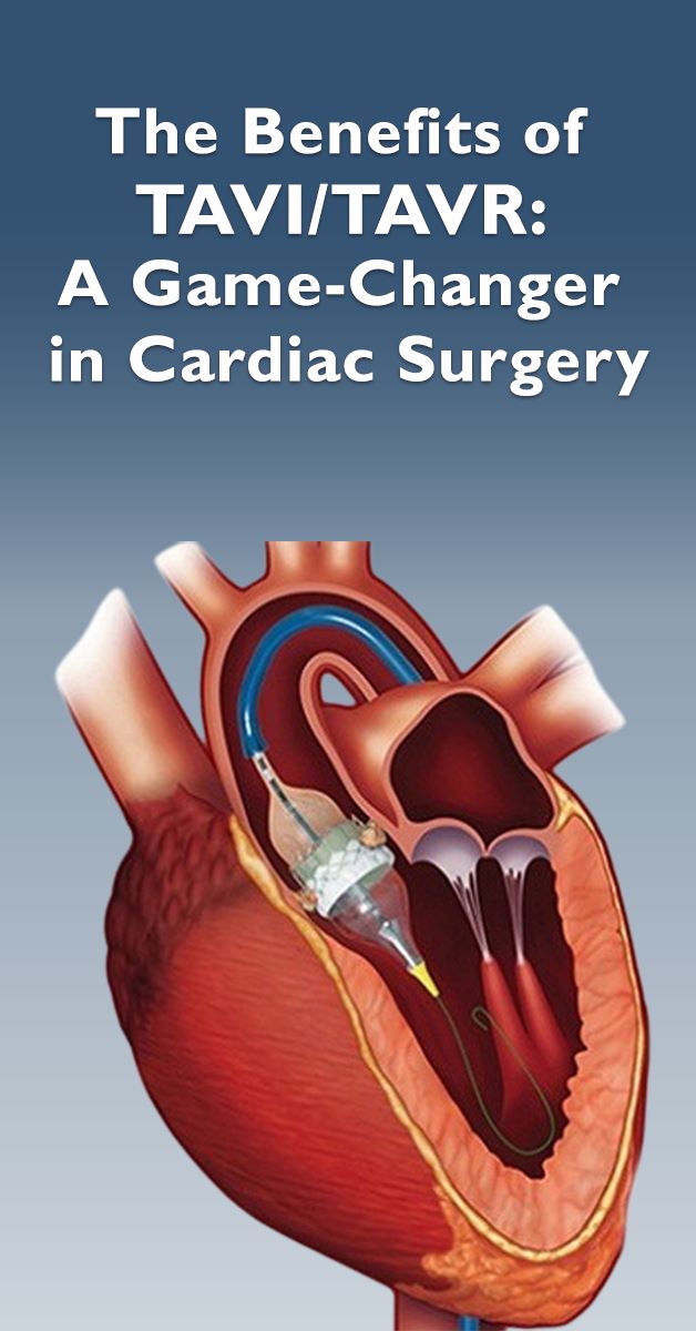 Dr Manish Garg – Cardiac Surgeon in Mumbai